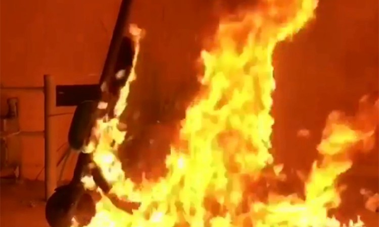 स्कुटरको ब्याट्री पड्कदा ८ घन्टा अस्पतालमा (भिडियाेसहित)_img